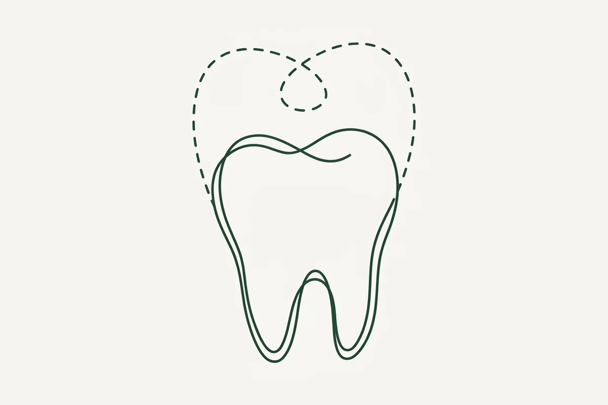 Un dente e, tratteggiata, la forma che aveva prima